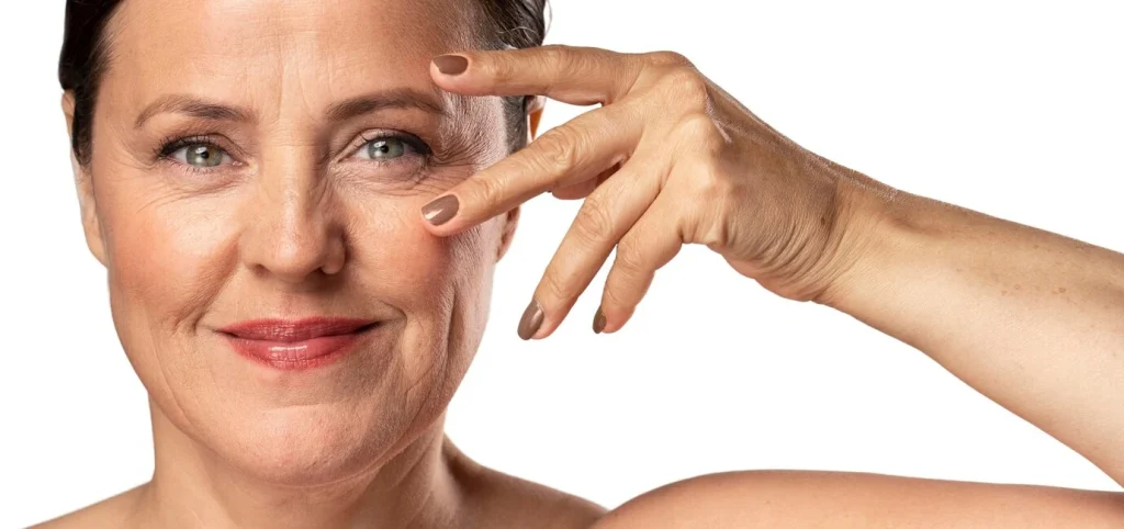 beneficios-blefaroplastia