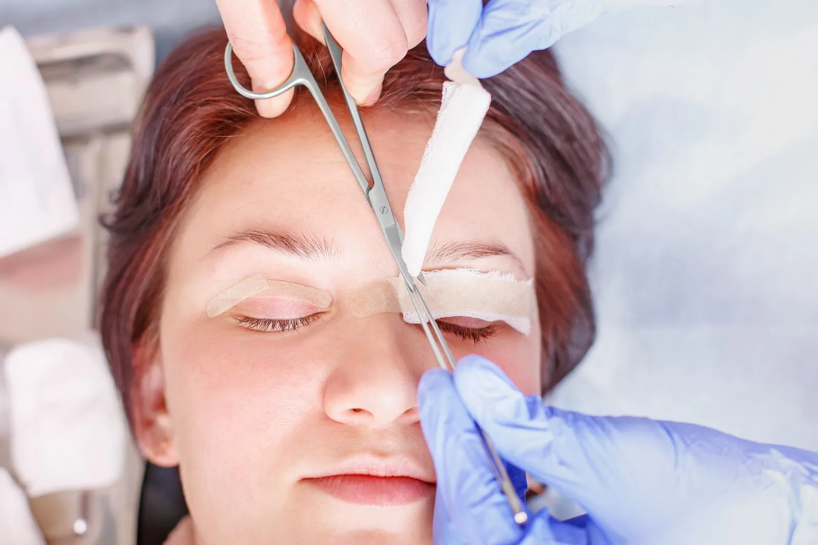 blefaroplastia-la-cirugia-del-parpado