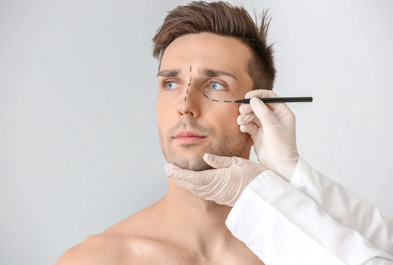 blefaroplastia-masculina