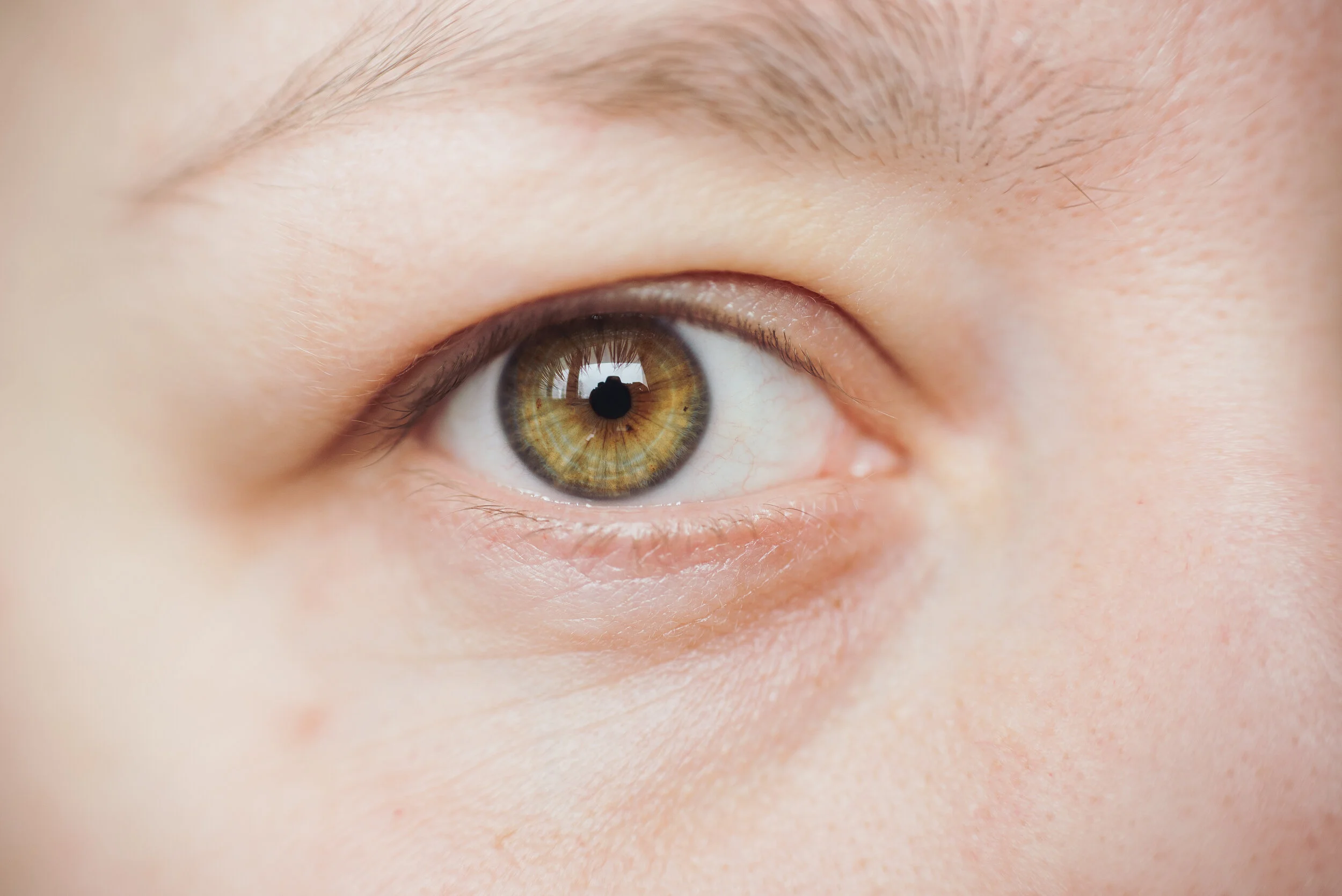 blefaroplastia-superior