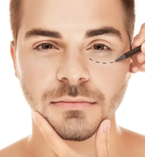 cirugia-de-parpados-en-hombres
