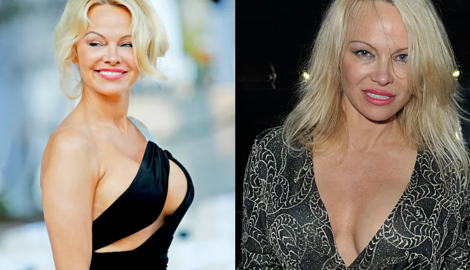 mujeres que se han quitado las protesis pamela anderson