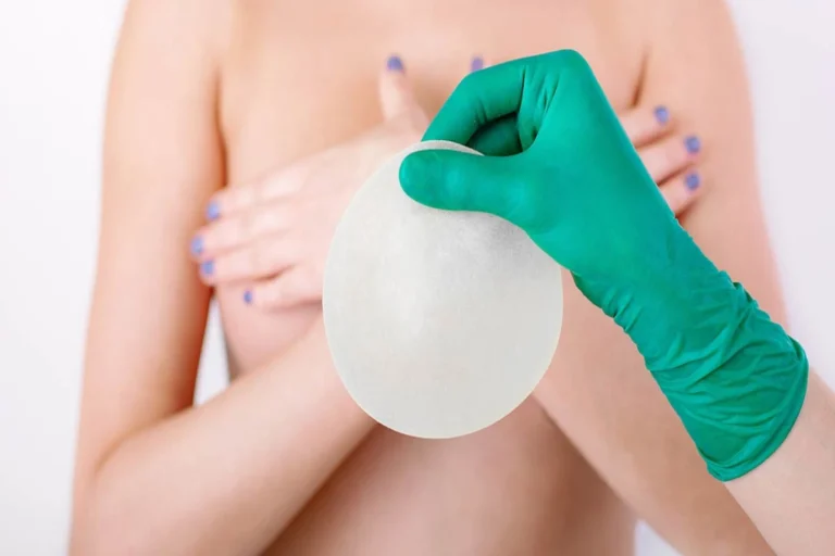 ¿Cuánto duran los implantes de pecho?