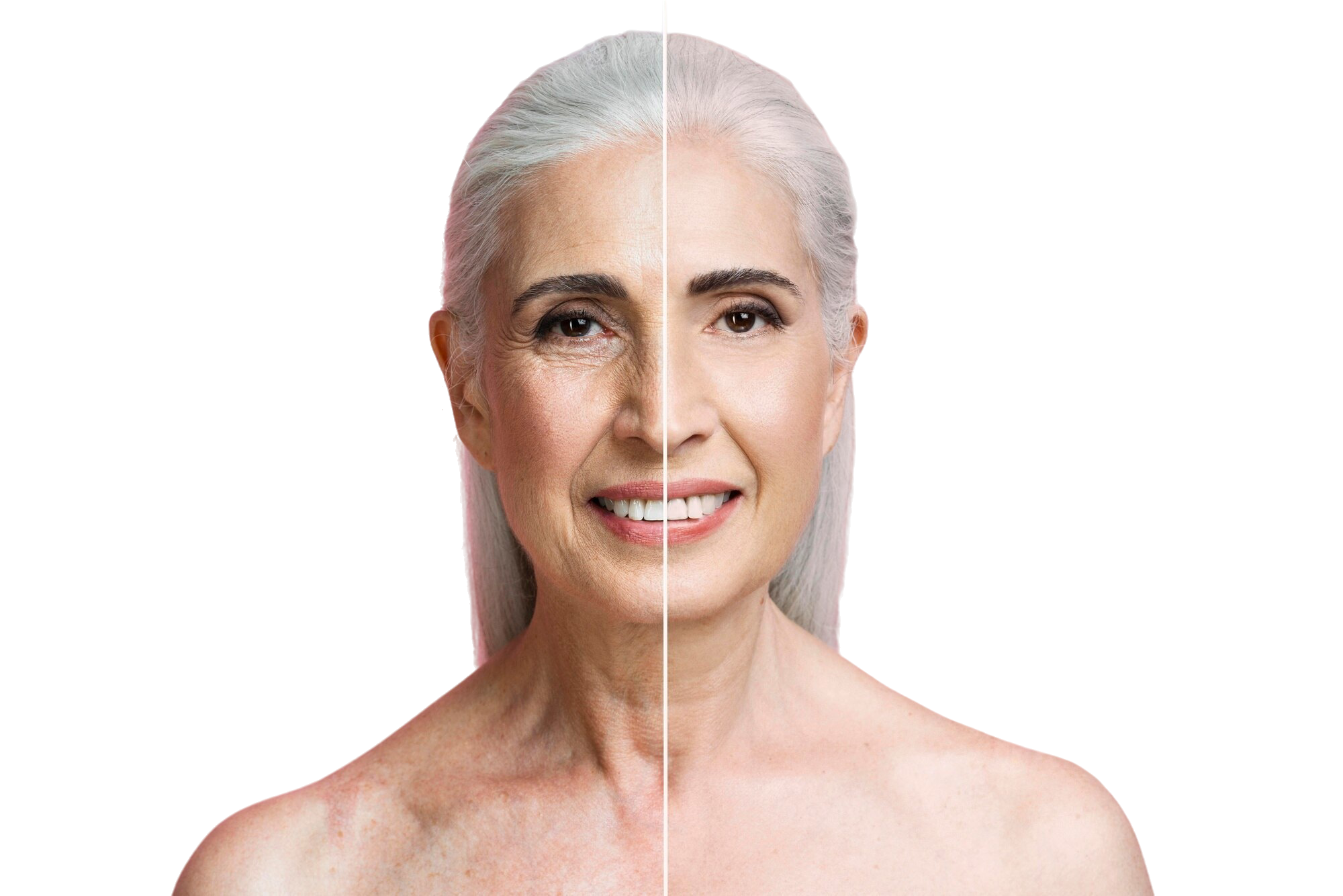 rejuvenecimiento facial antes despues